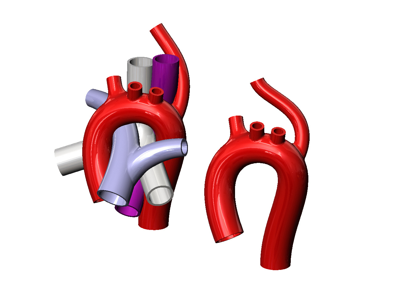 20-facts-about-aberrant-subclavian-artery