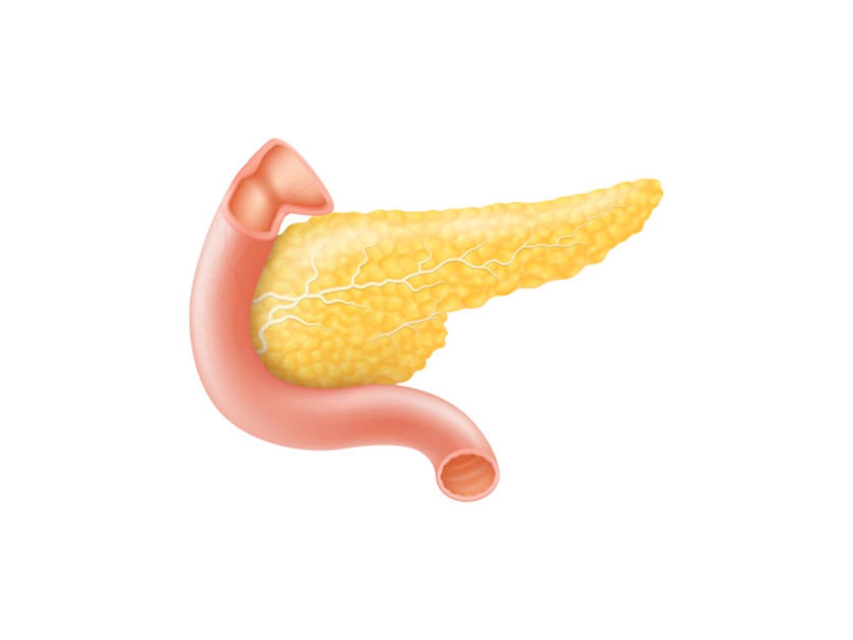 20-facts-about-accessory-pancreas