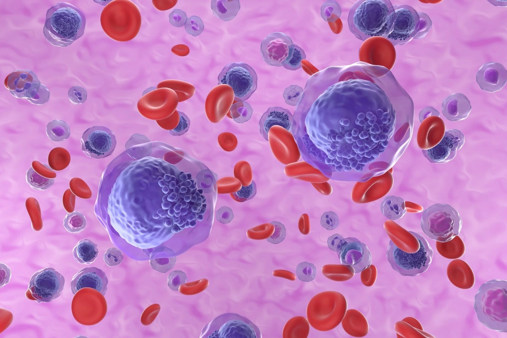 20-facts-about-acute-myeloblastic-leukemia