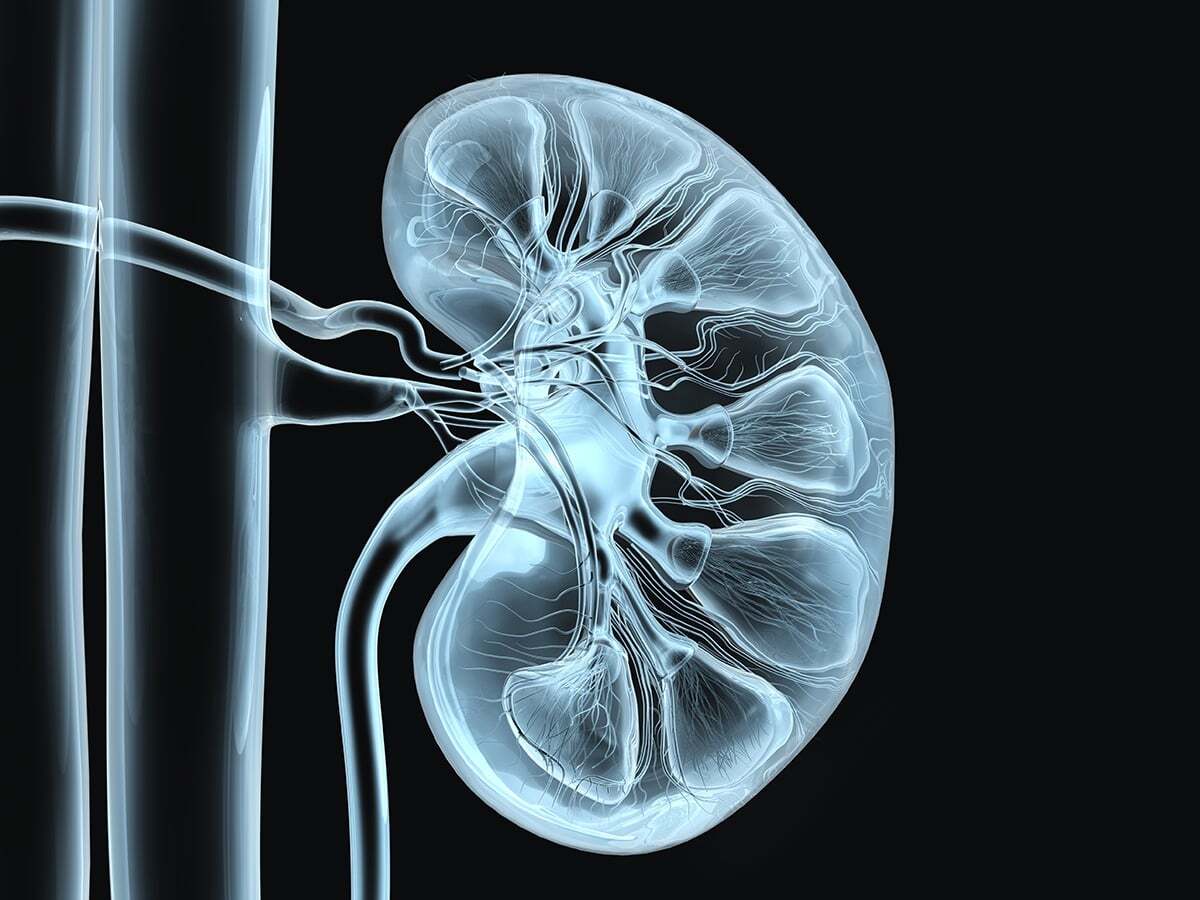 20-facts-about-cardiorenal-syndrome