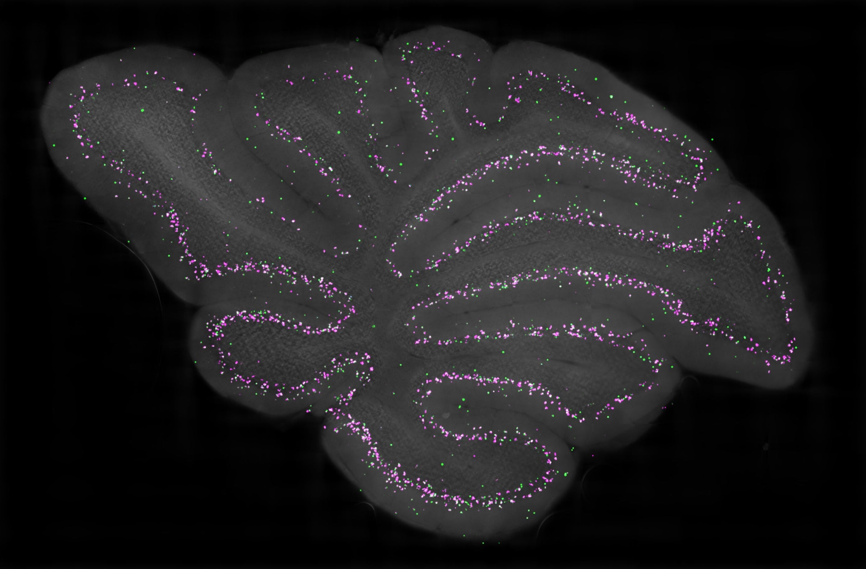 22-facts-about-cerebellar-cortex