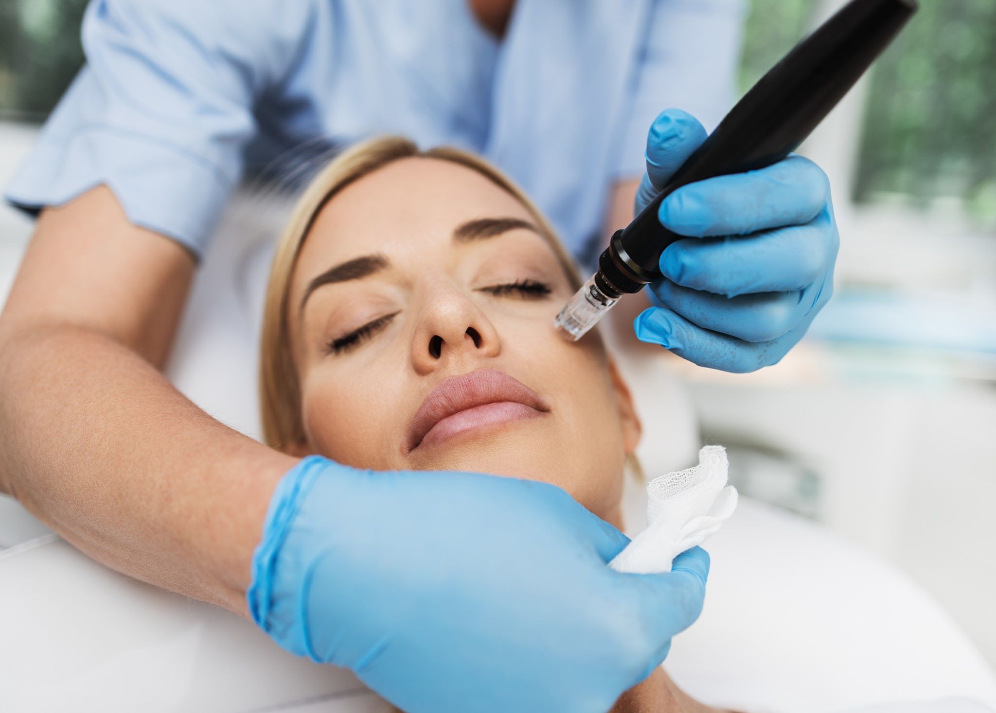 24-facts-about-microneedling-roller