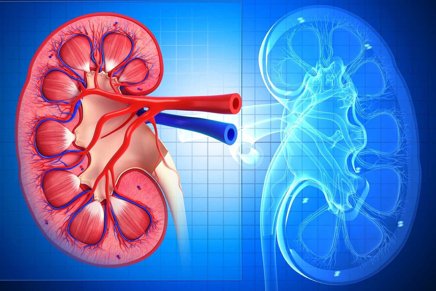 30-facts-about-acute-renal-failure