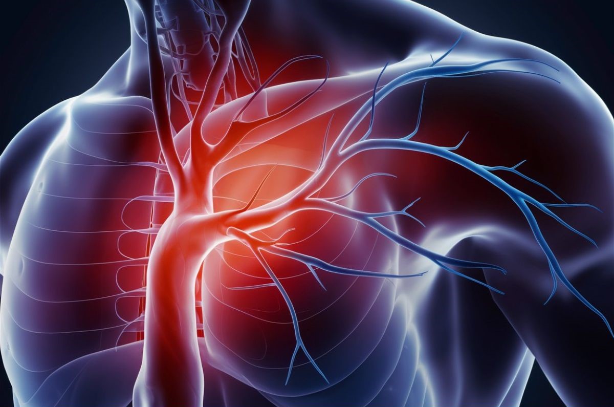 30-facts-about-subclavian-artery