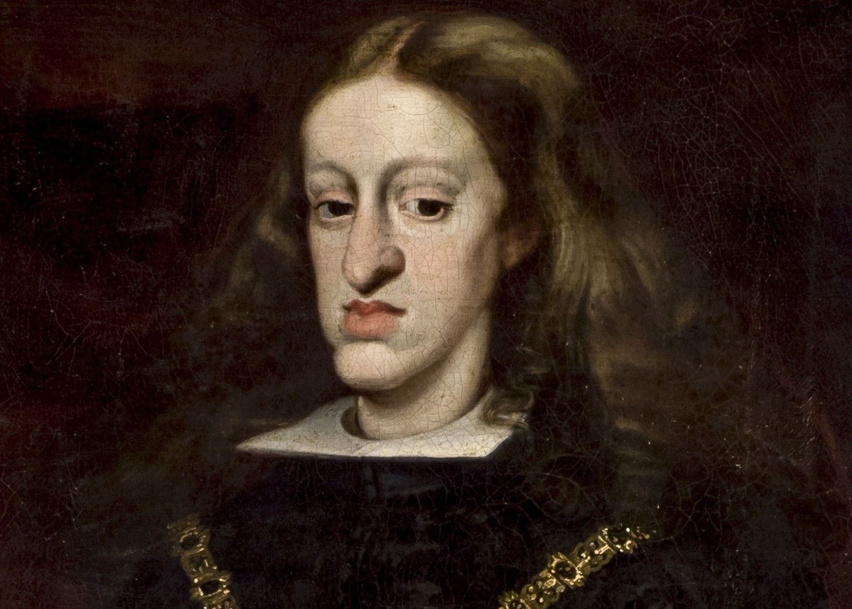 34 Facts About Habsburg Jaw - Facts.net