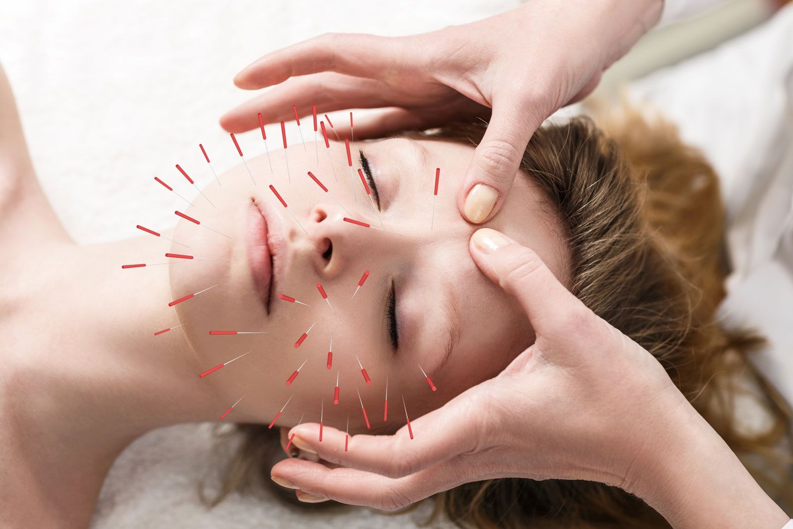 40-facts-about-acupuncture