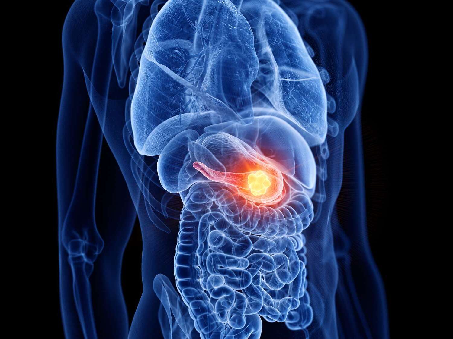 50-facts-about-pancreatitis