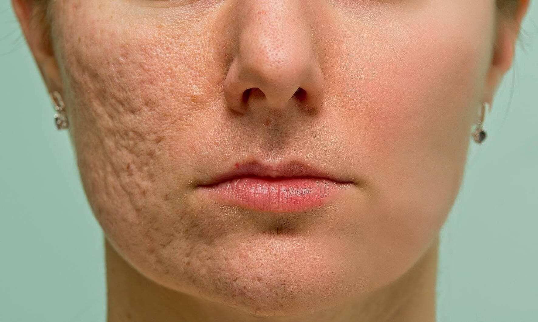 27-facts-about-improved-skin-texture