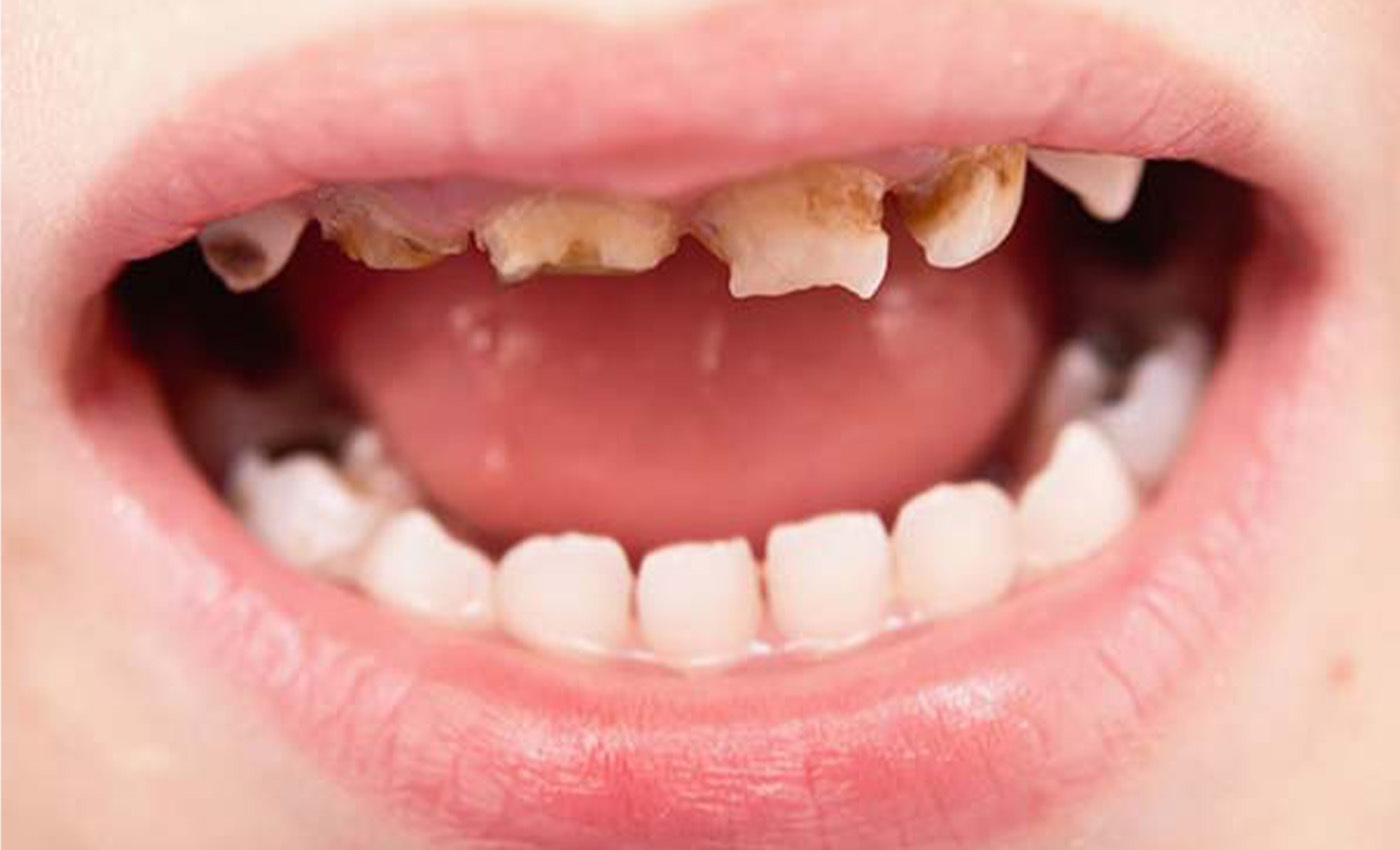 30-facts-about-dental-issues