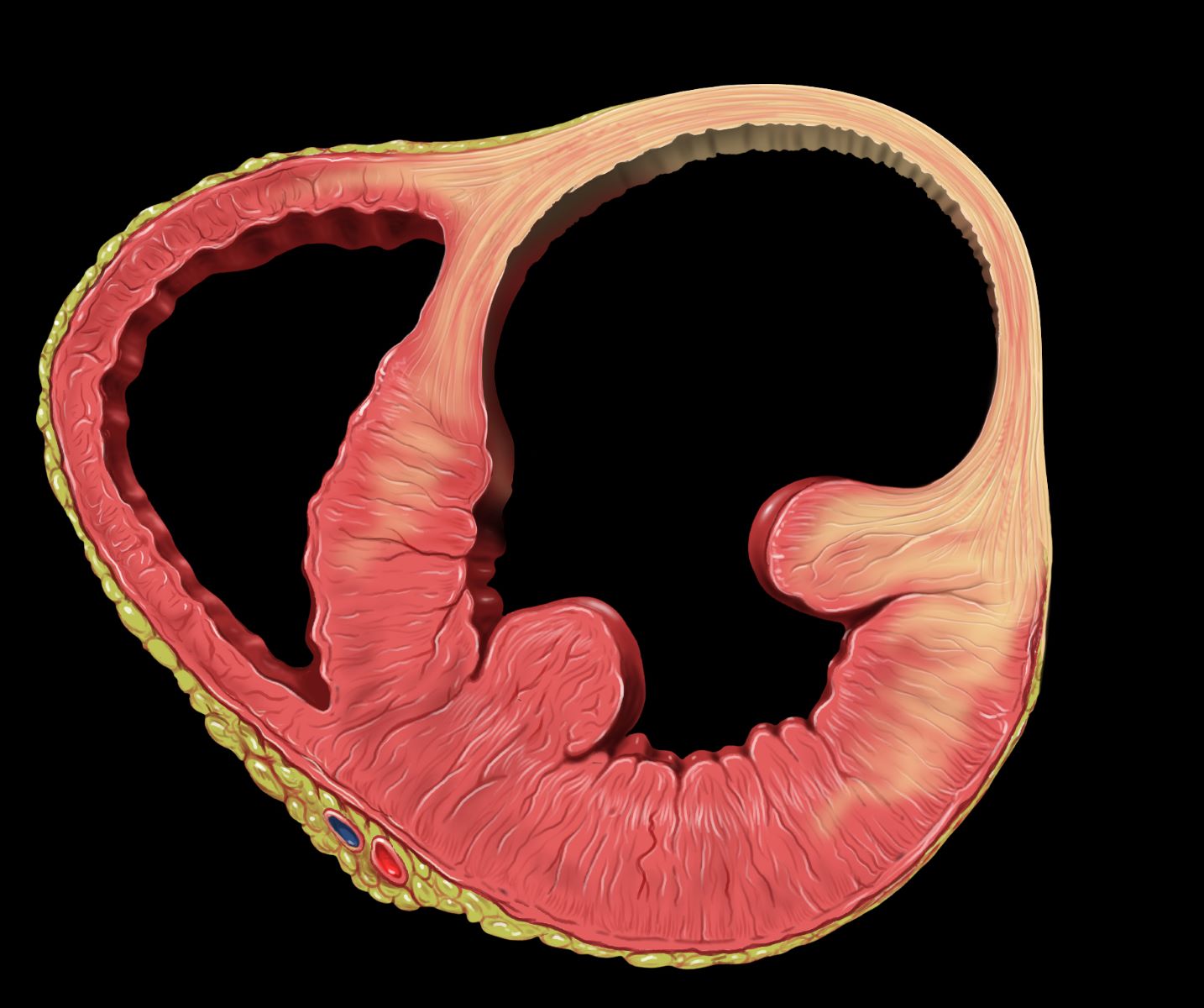 30-facts-about-fetal-left-ventricular-aneurysm