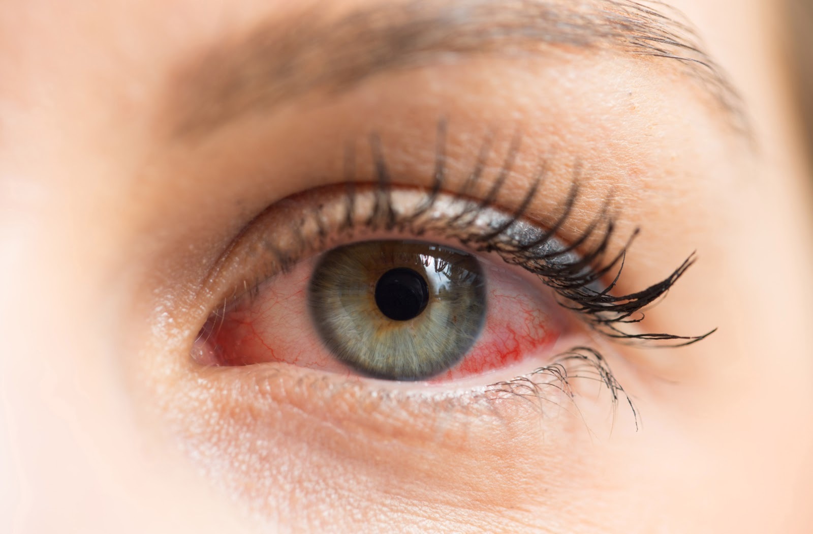 30-facts-about-phantom-eye-syndrome