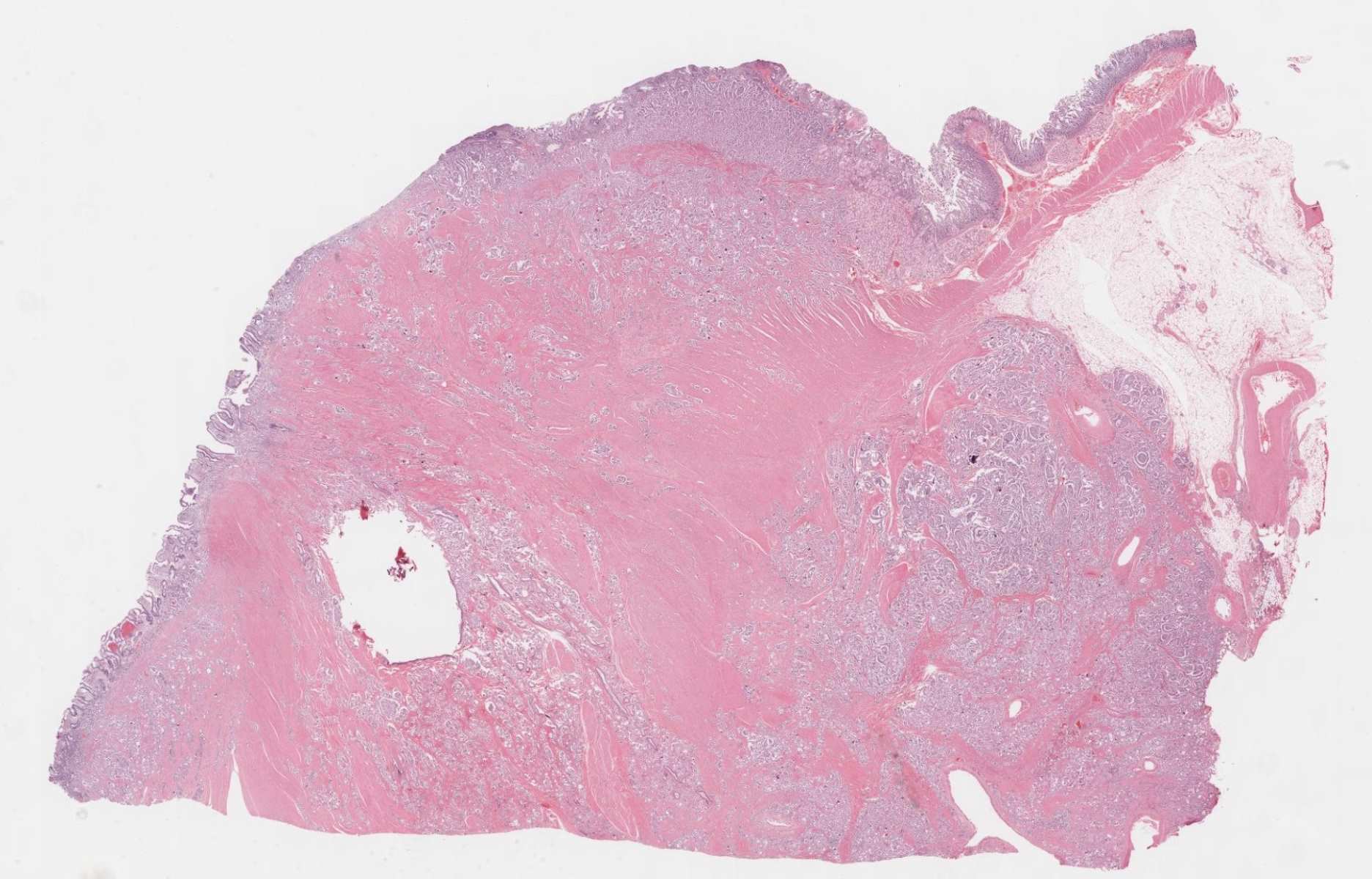 30-facts-about-somatostatinoma-syndrome