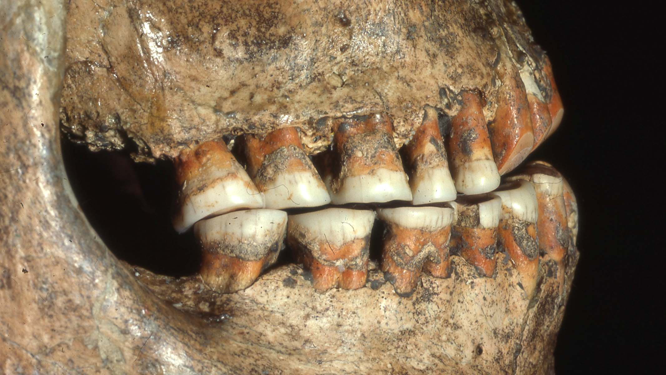 35-facts-about-cavemen-teeth