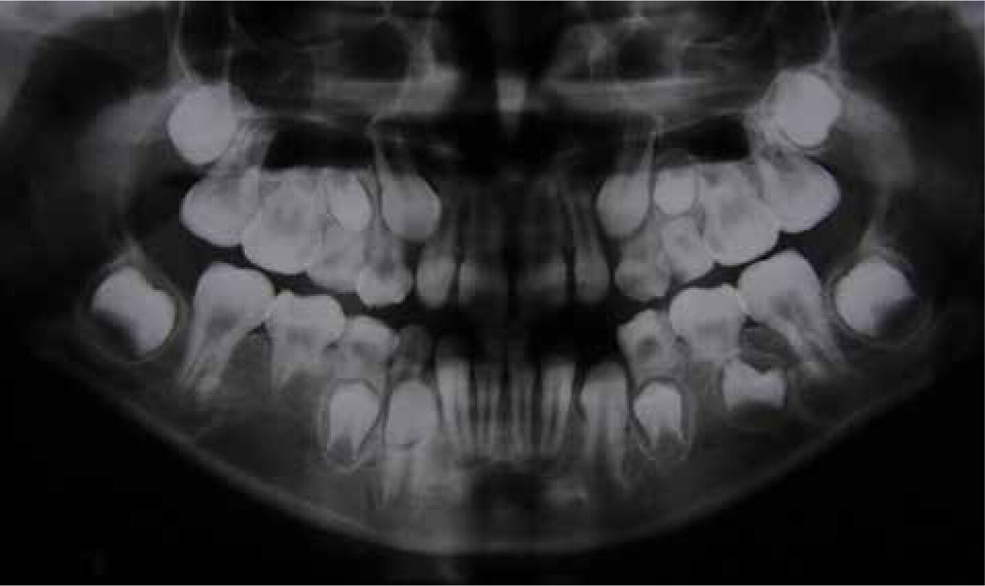 35-facts-about-otodental-syndrome