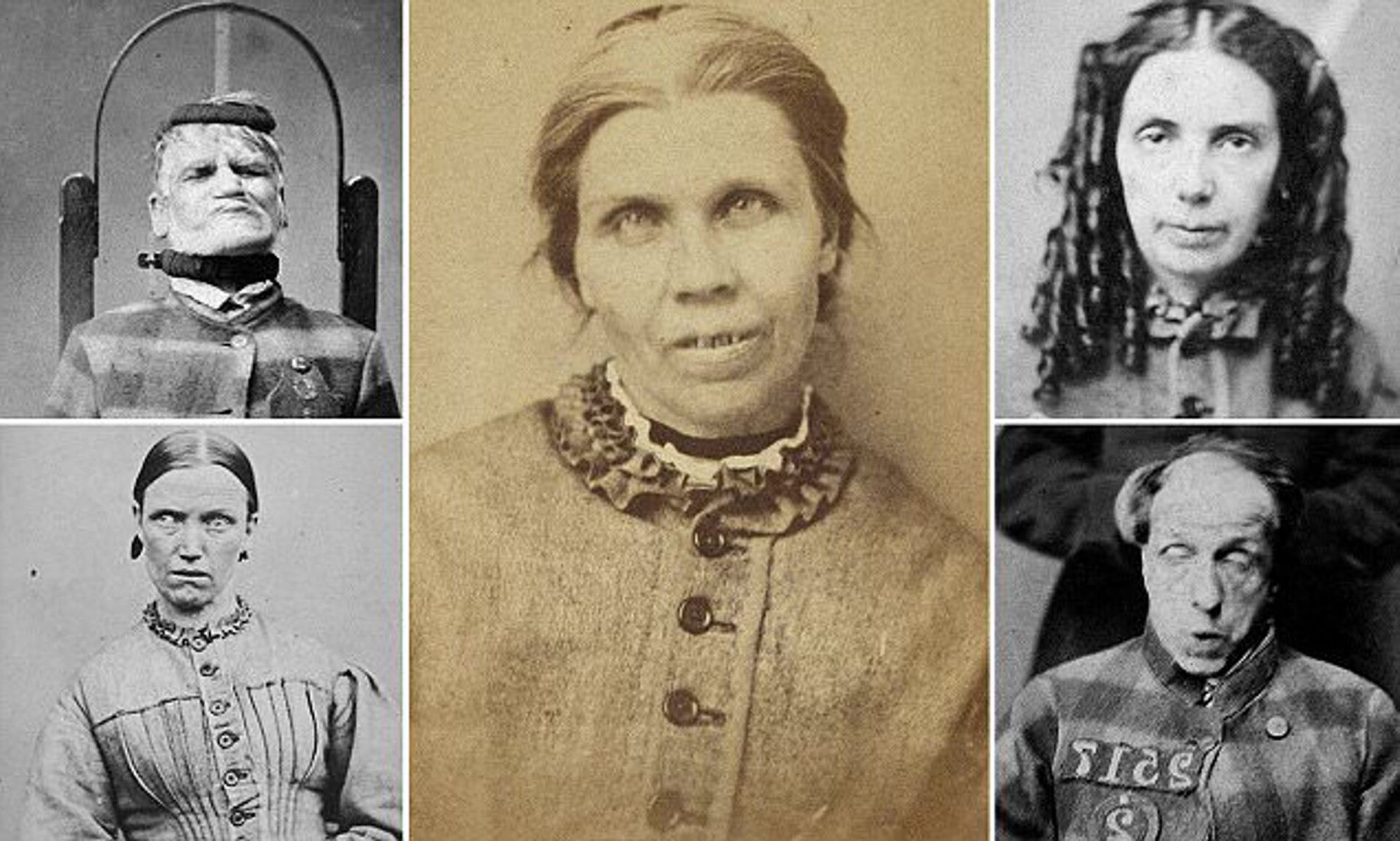 35-facts-about-victorian-mental-asylum-portraits