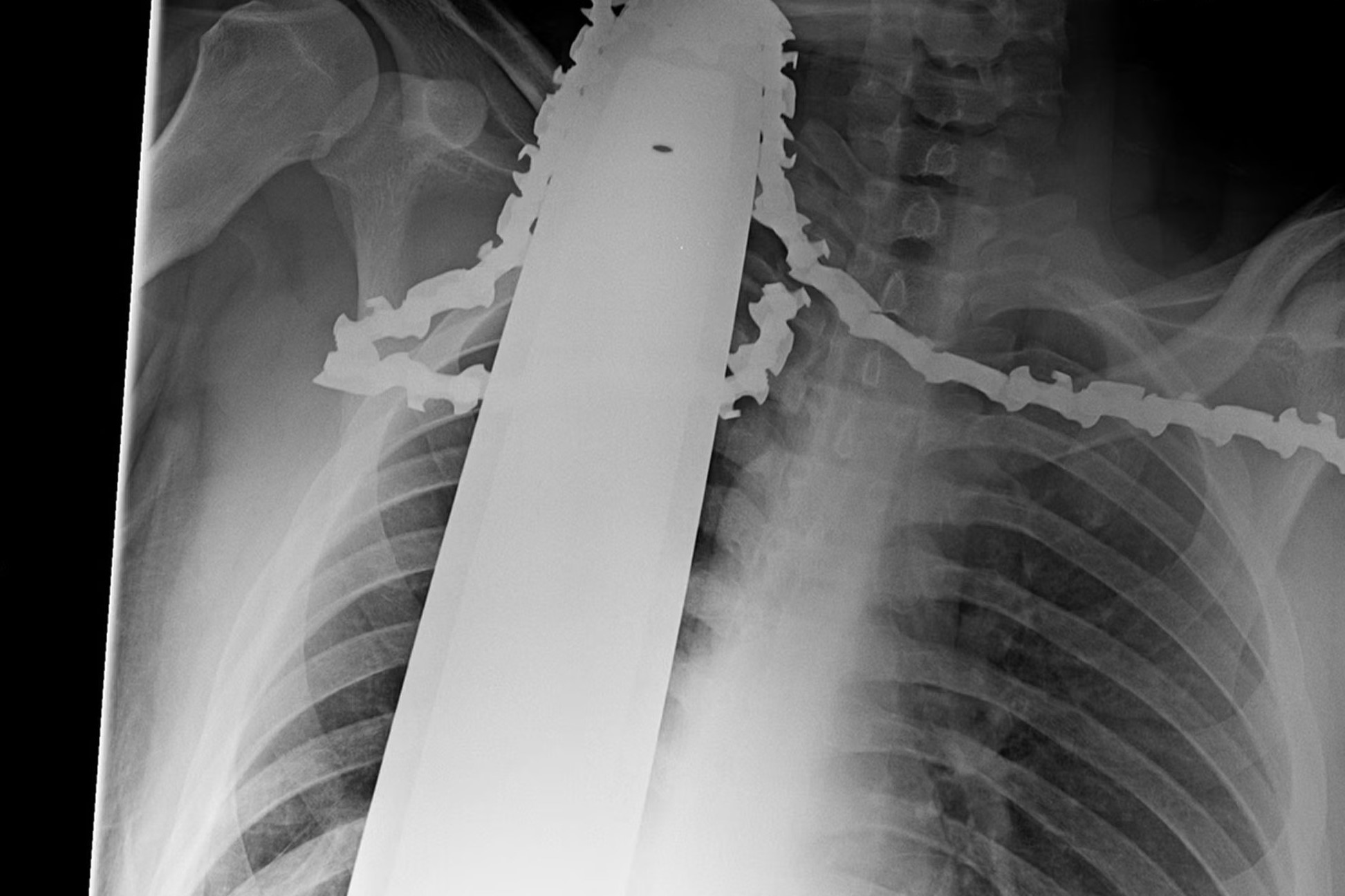 38-facts-about-weirdest-x-rays