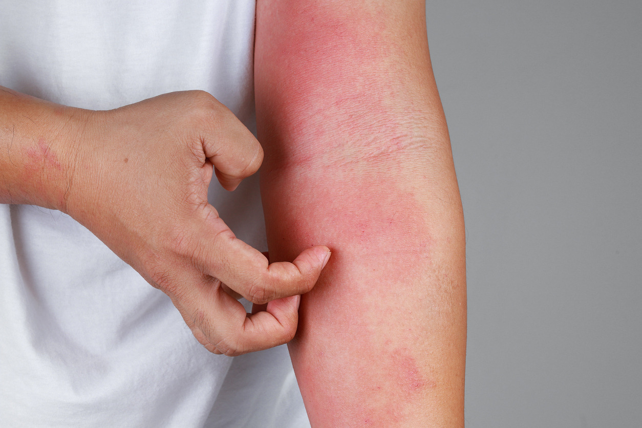 40-facts-about-skin-irritation