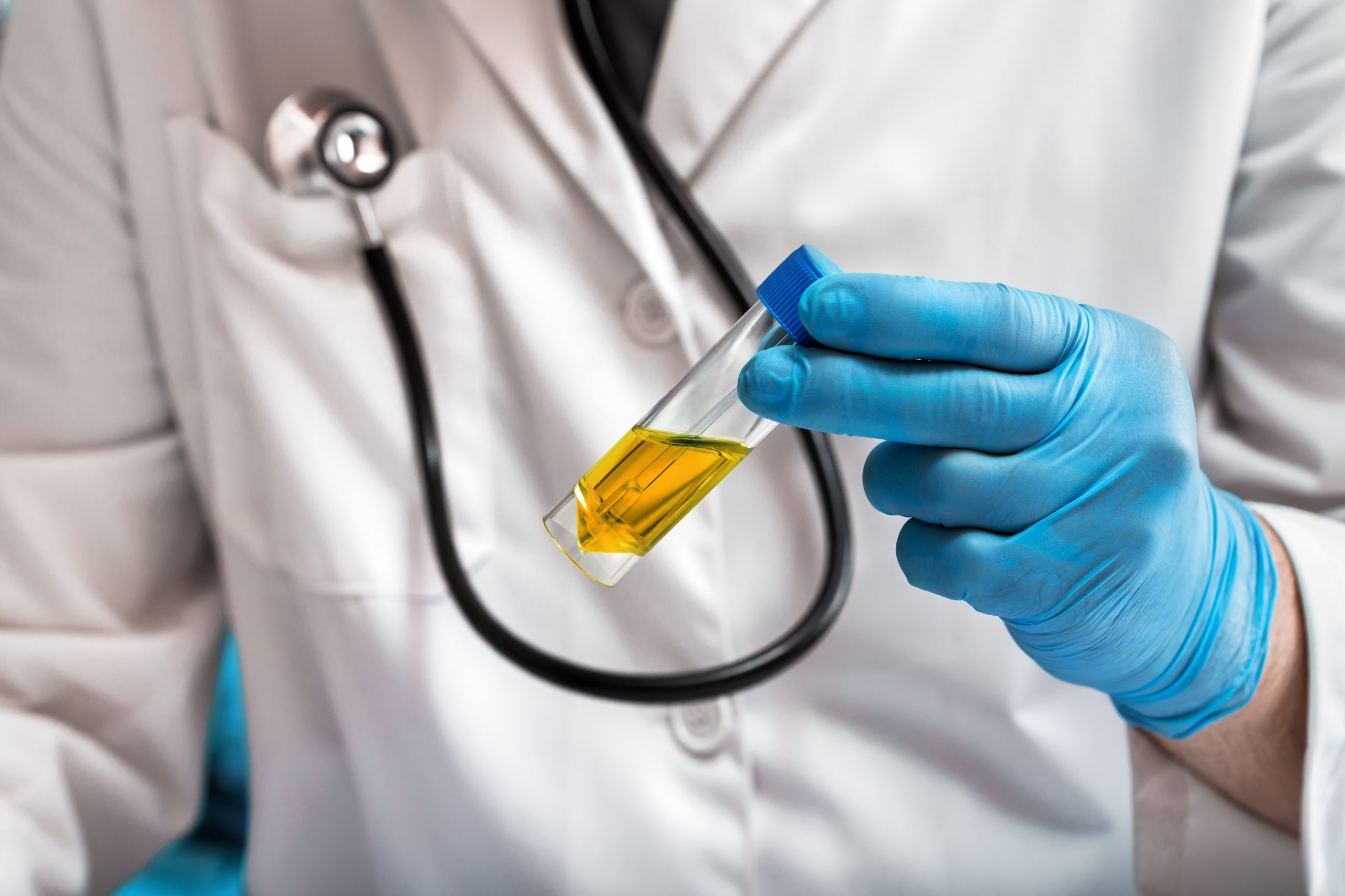 40-facts-about-urine-tests