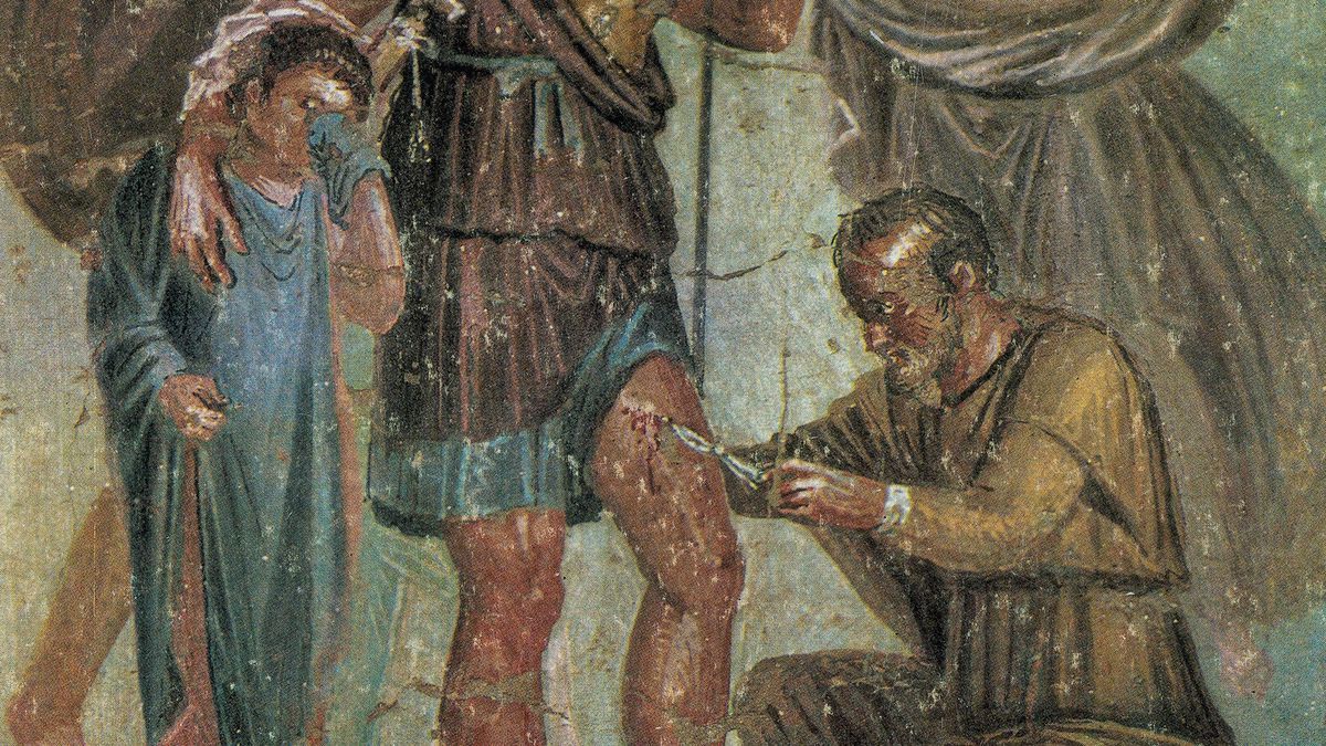 45-facts-about-ancient-roman-surgery