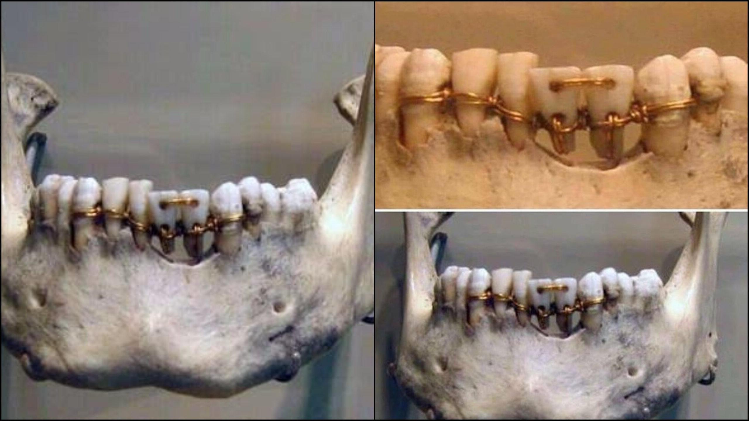 45-facts-about-egyptian-dentistry