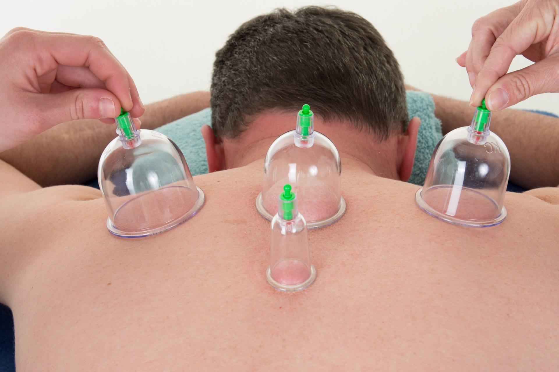 45-facts-about-hijama