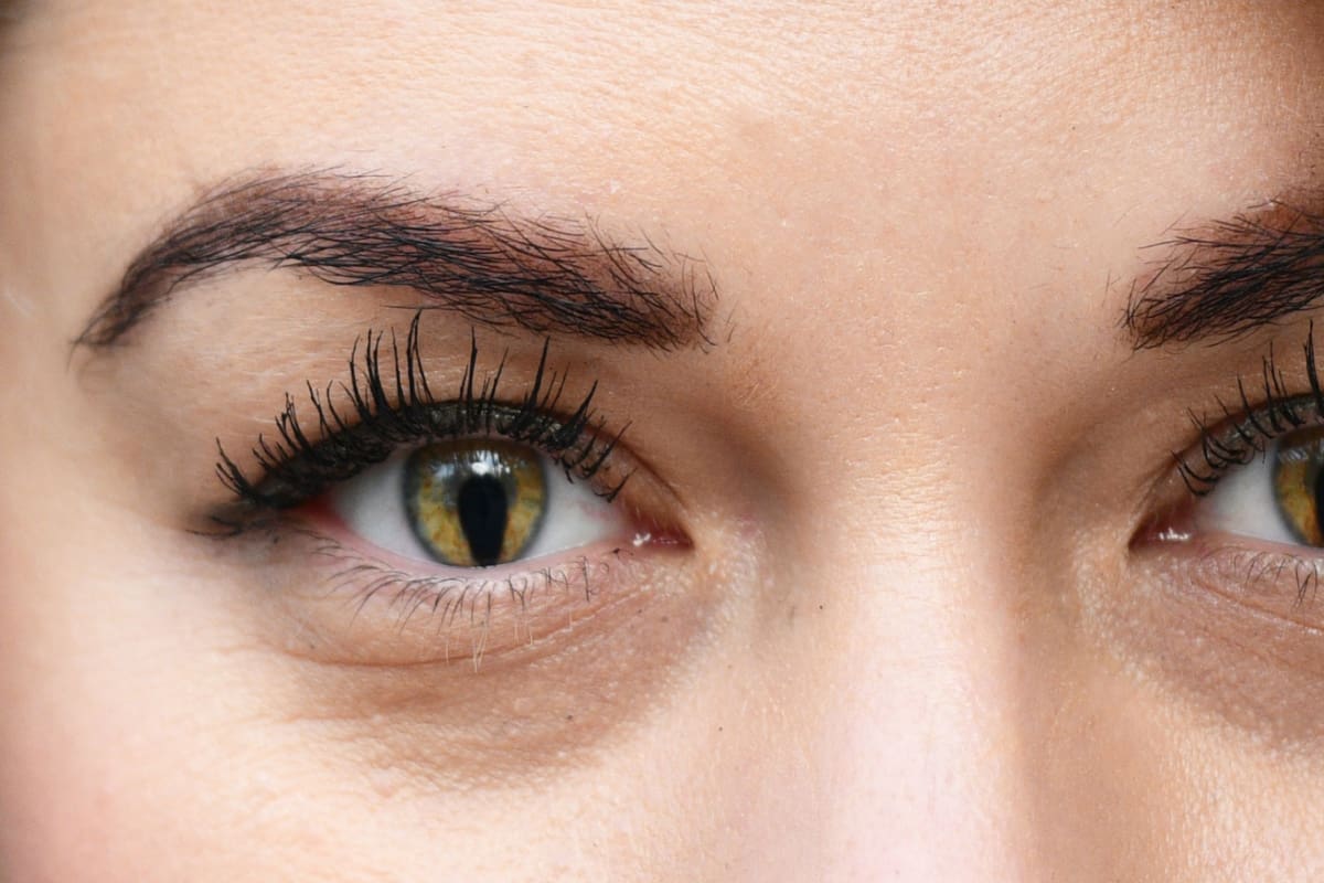 50-facts-about-coloboma