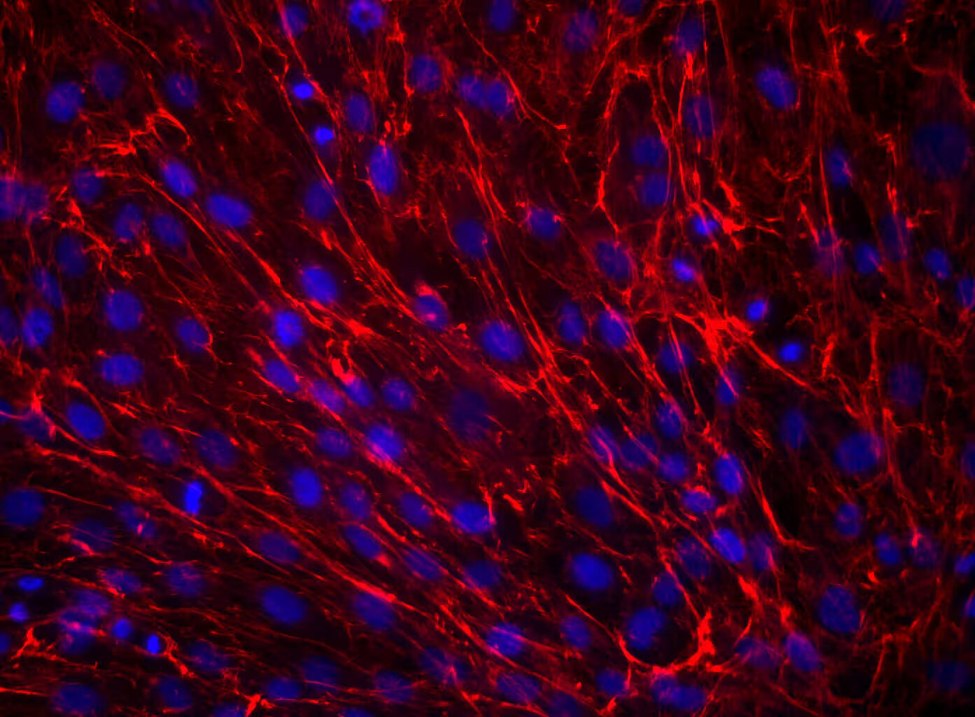 50-facts-about-fibronectin