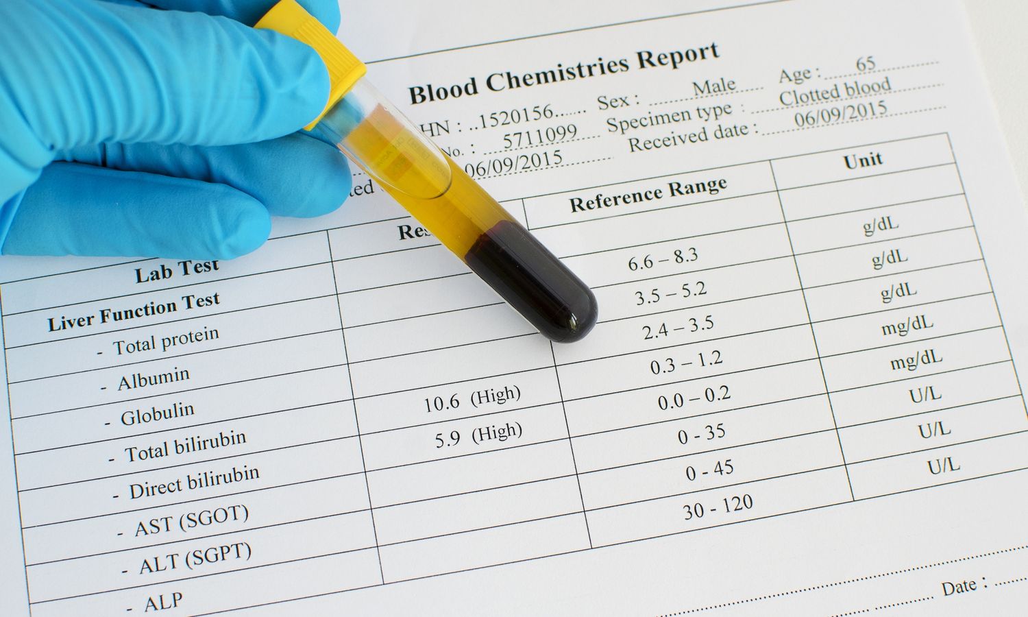 50-facts-about-globulin