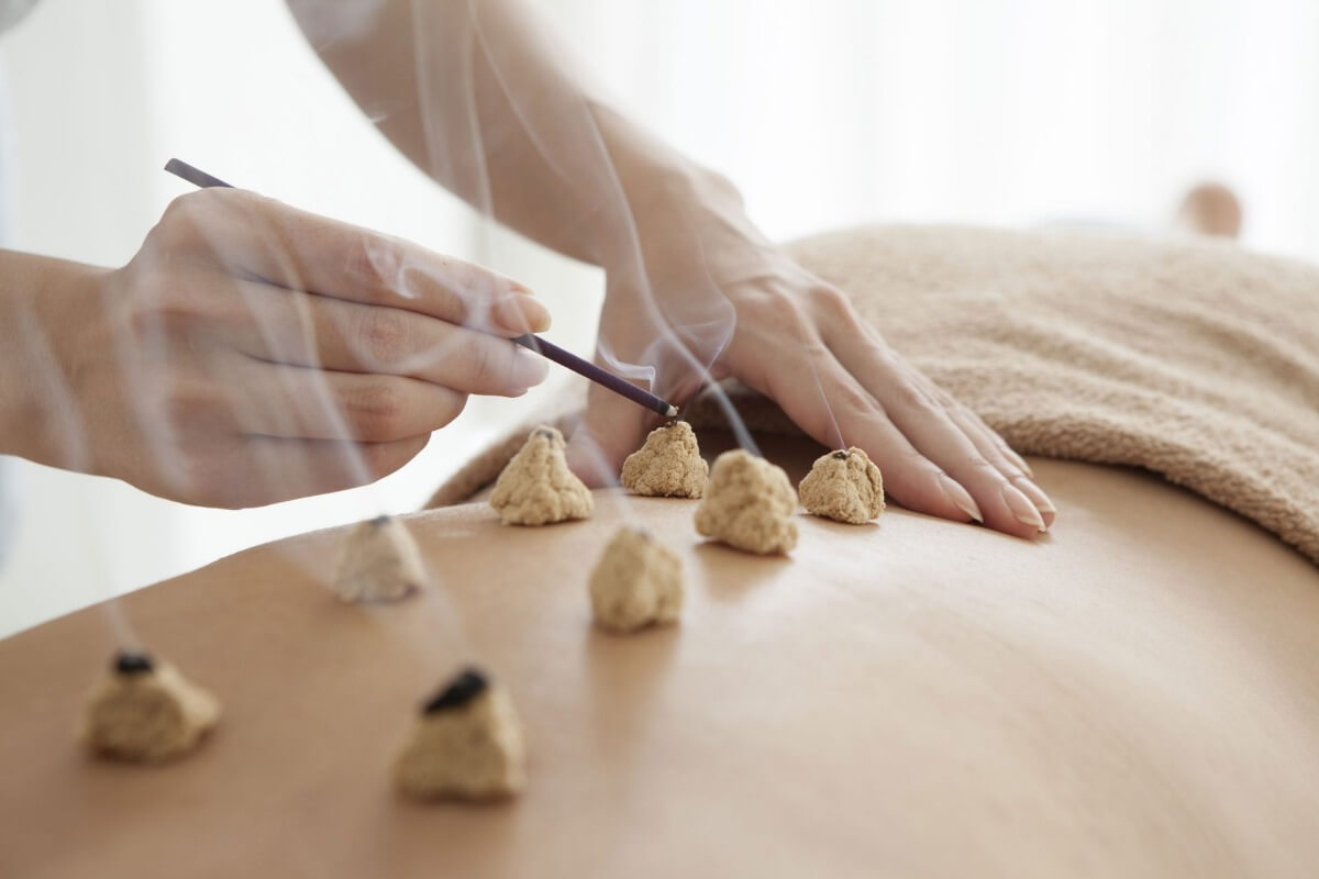 50-facts-about-moxibustion