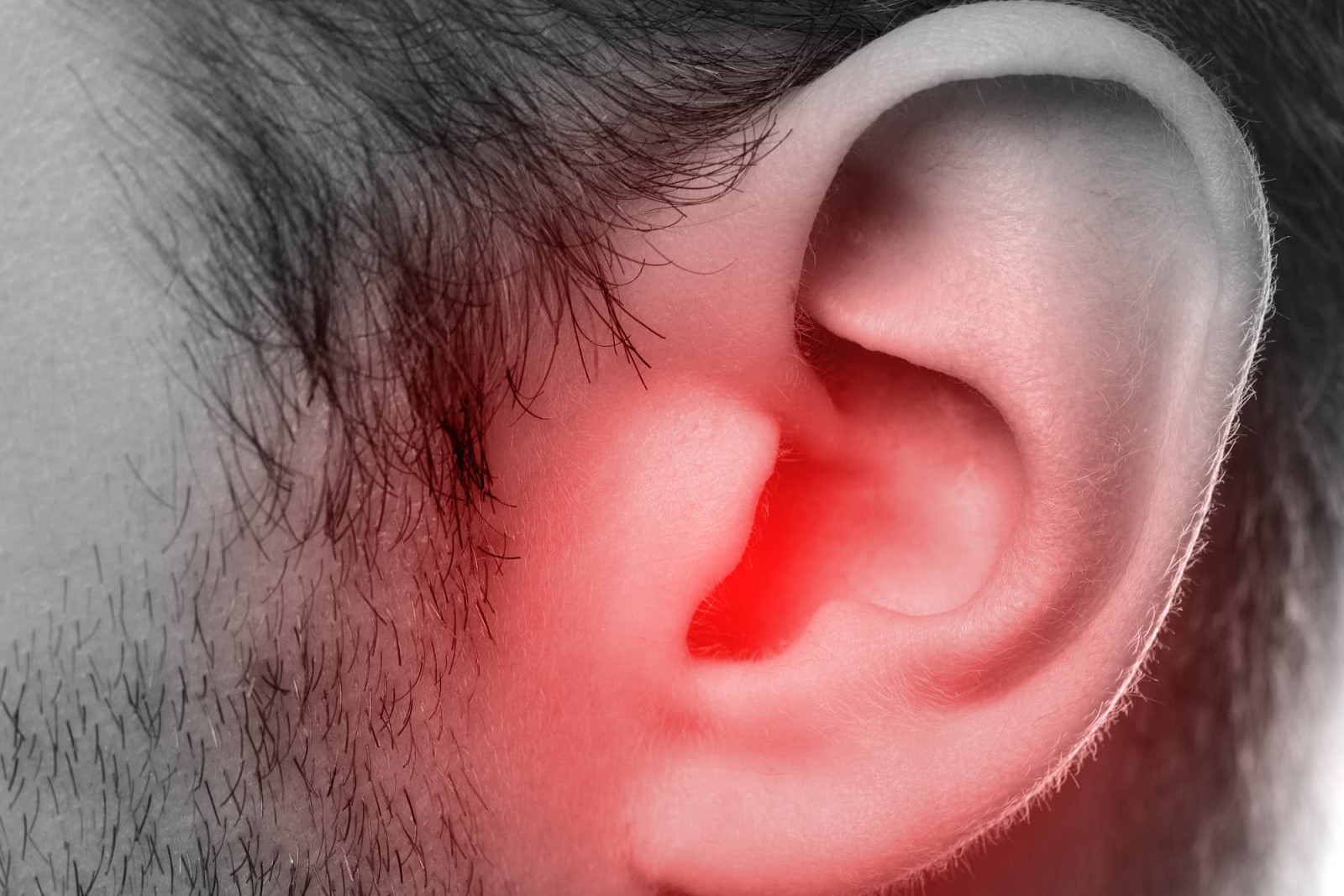 50-facts-about-red-ear-syndrome