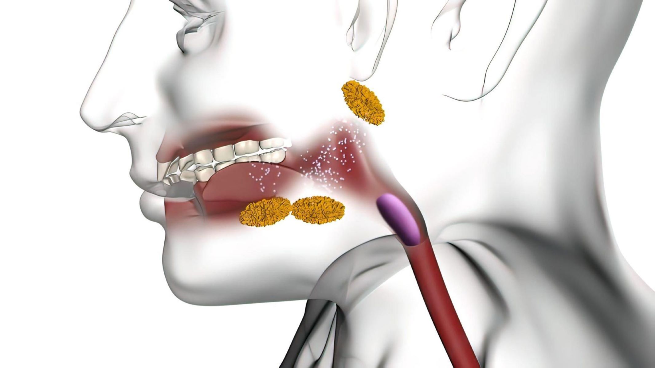 25-facts-about-hypopharyngeal-cancer-head-and-neck-cancer