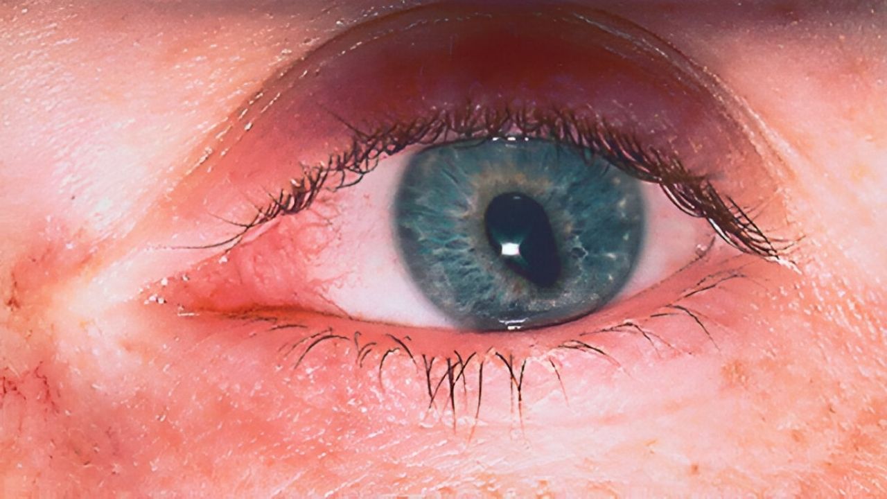 30-facts-about-egg-shaped-pupils