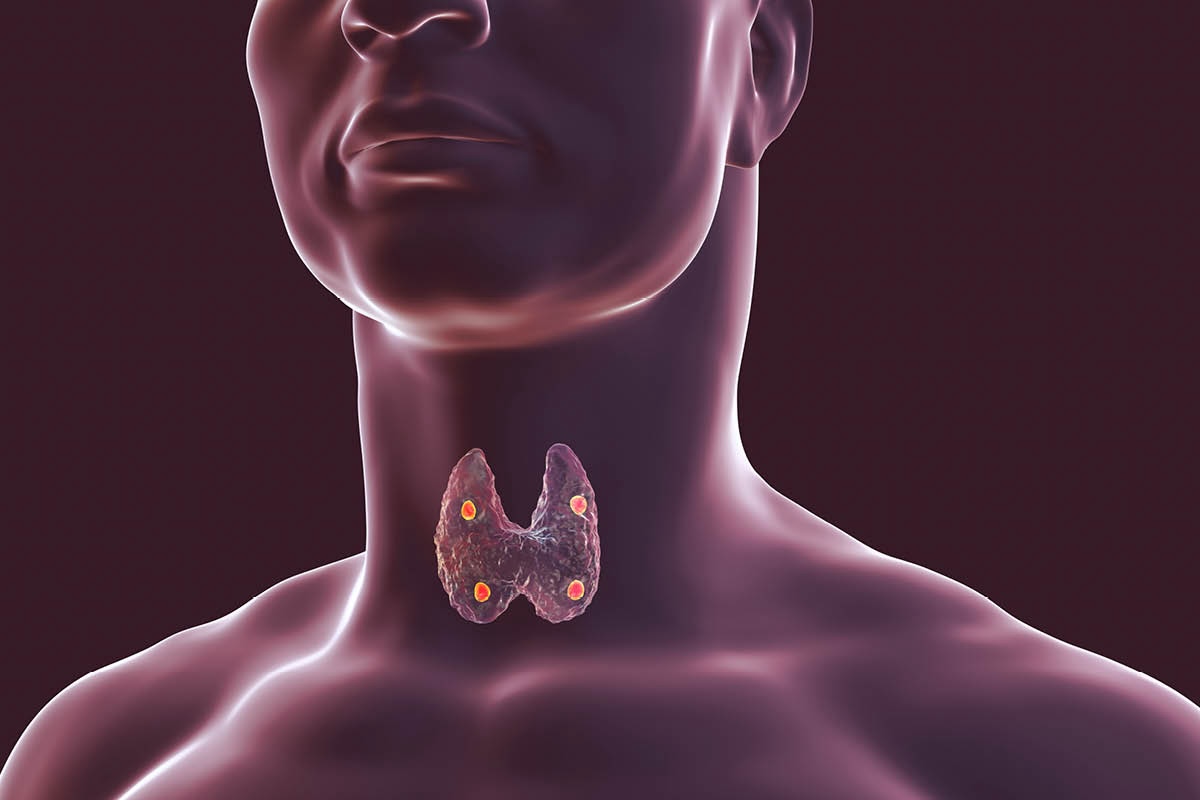 30-facts-about-familial-hypothyroidism