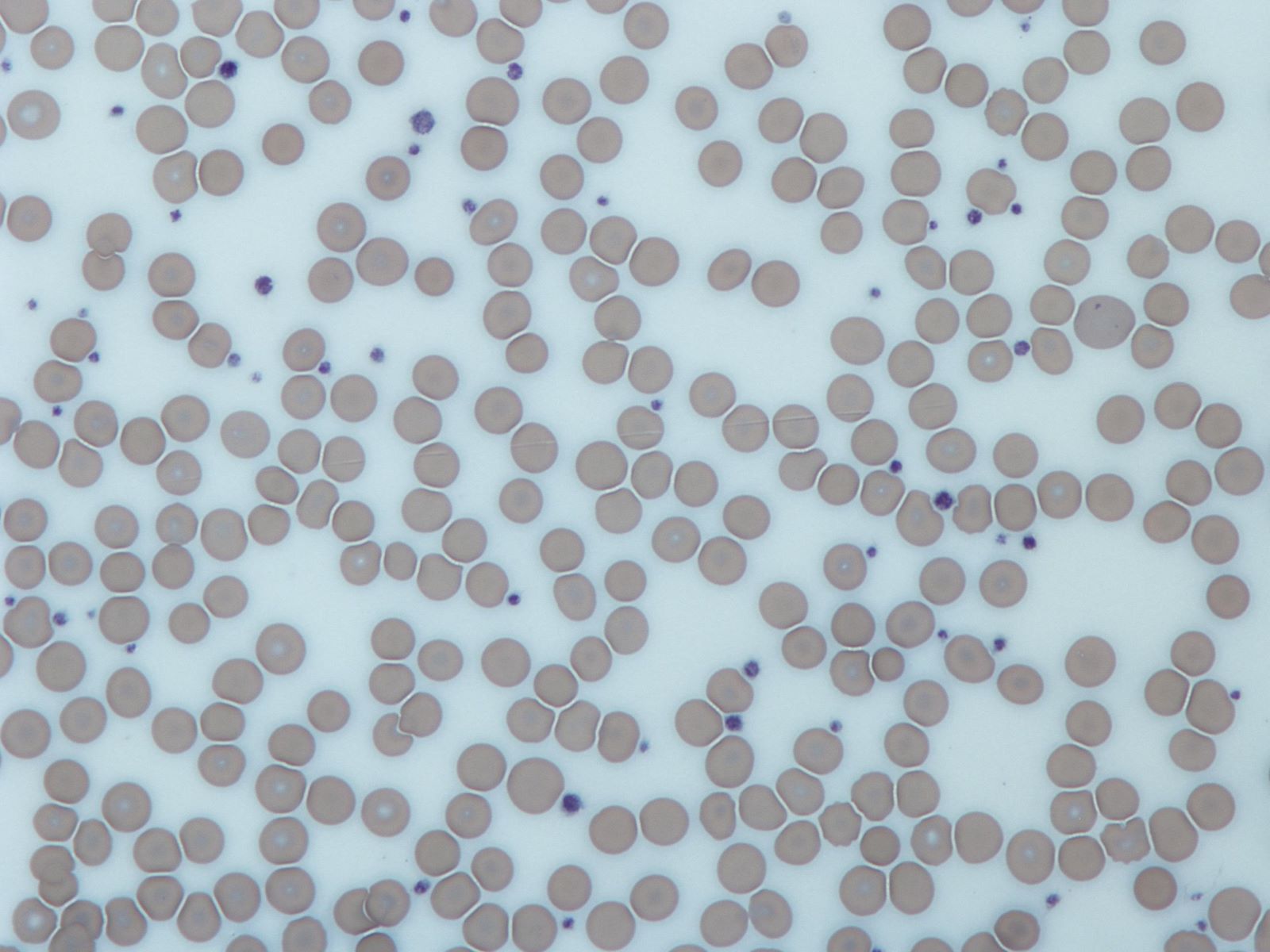 30-facts-about-gray-platelet