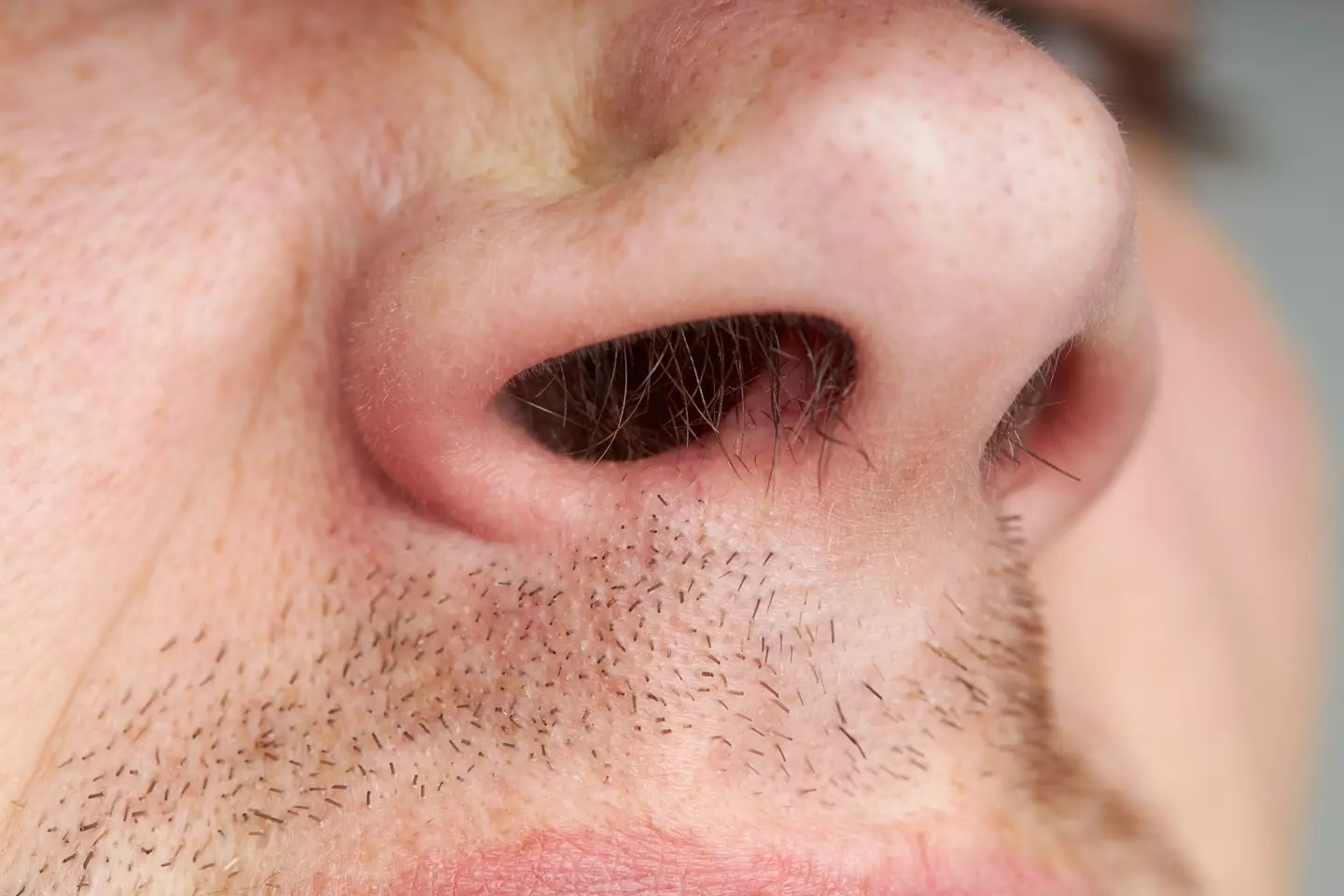 30-facts-about-hairy-nose-tip