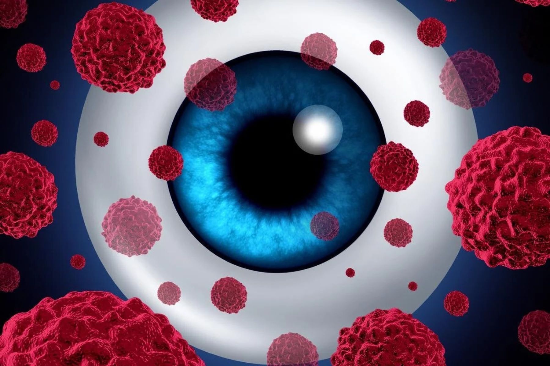 30-facts-about-intraocular-melanoma-eye-cancer