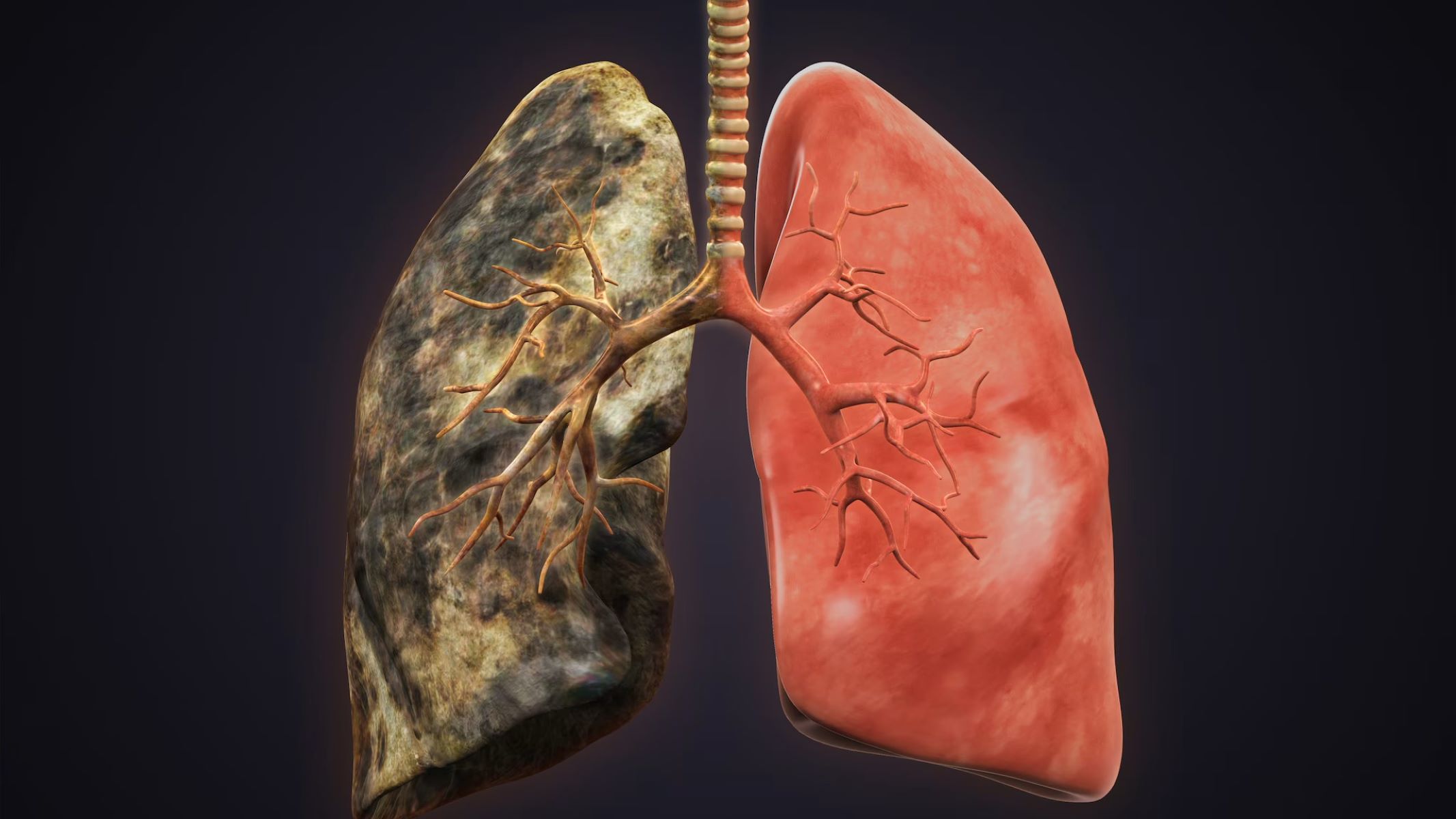 30-facts-about-kaolin-pneumoconiosis