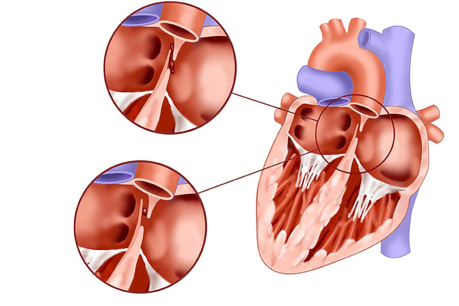 30-facts-about-laterality-defects-dominant