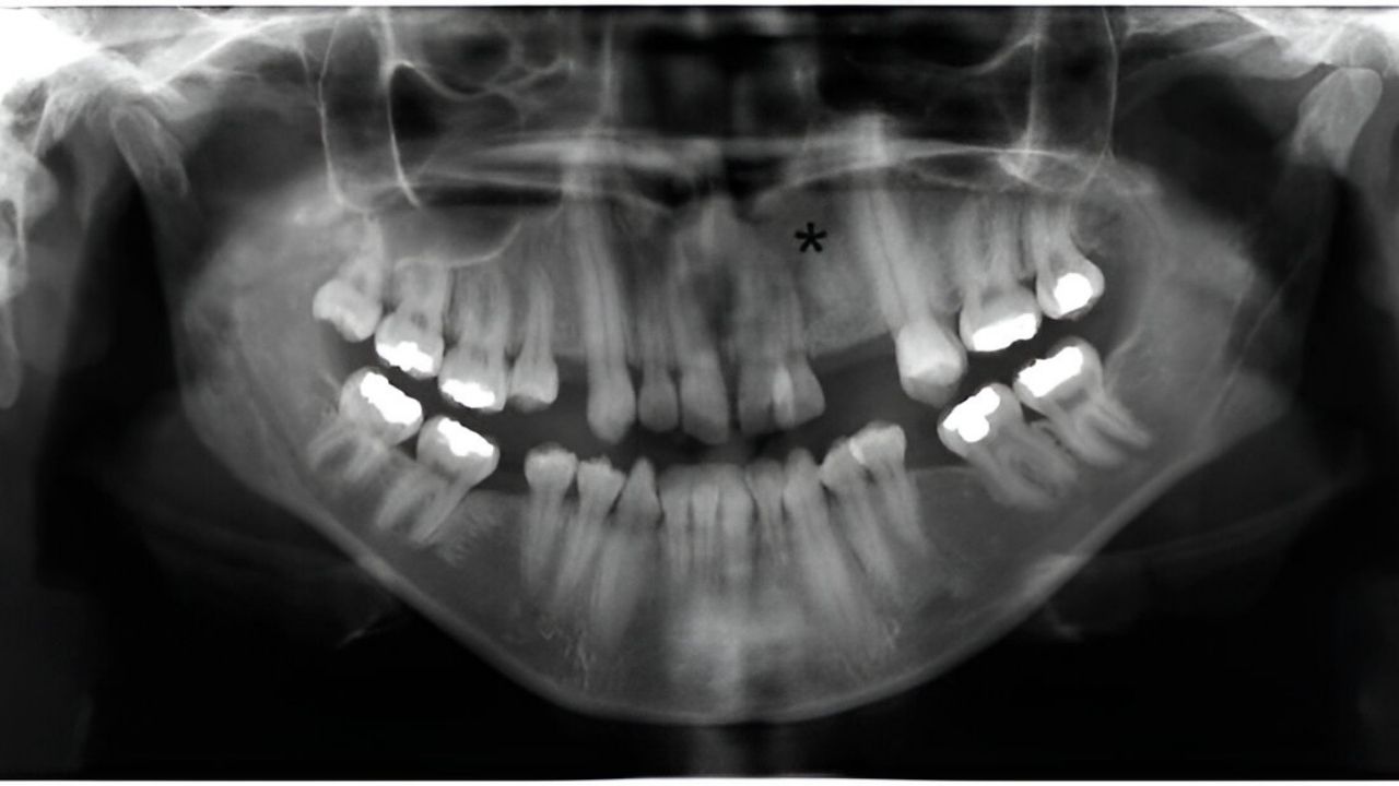 30-facts-about-oculo-facio-cardio-dental