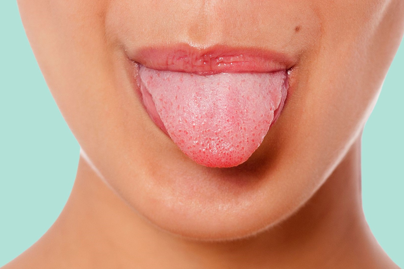 30-facts-about-tongue-neoplasm