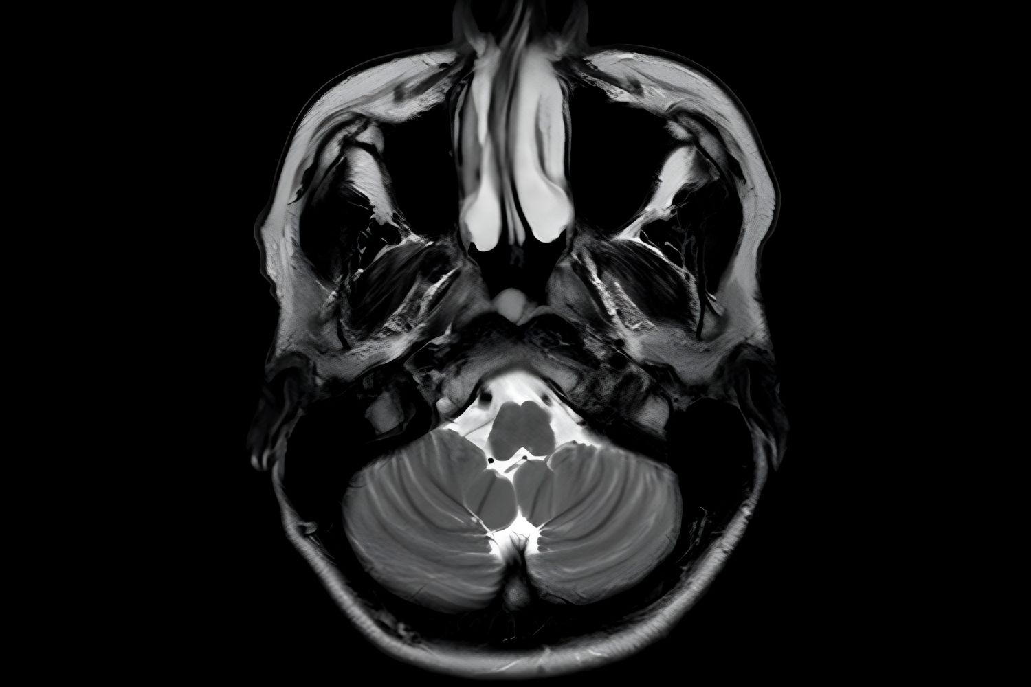 30-facts-about-tornwaldts-disease