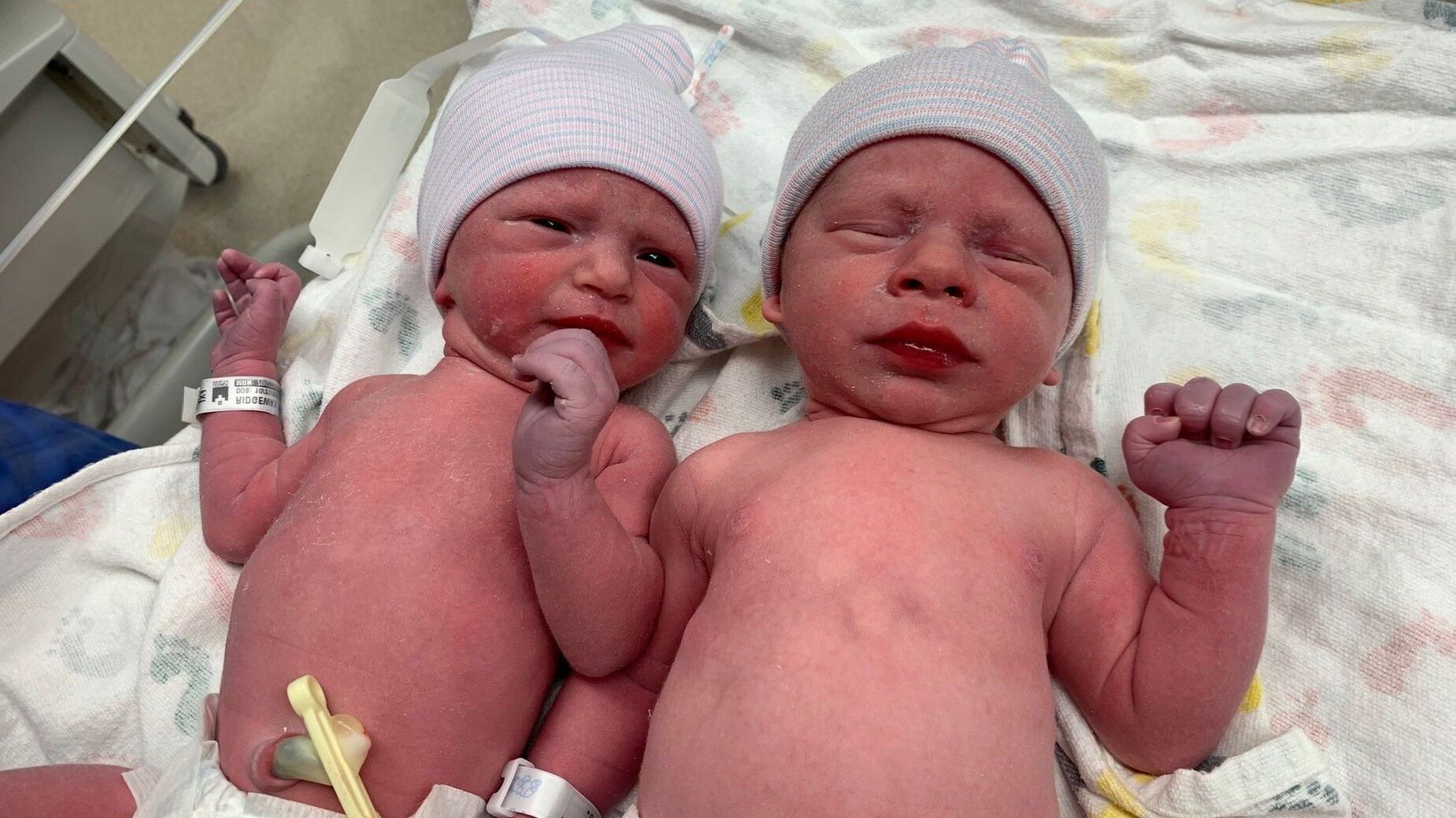 35-facts-about-frozen-embryo-twins