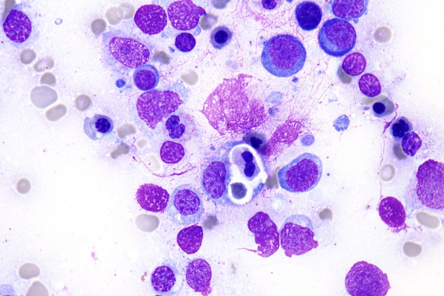 35-facts-about-hemophagocytes