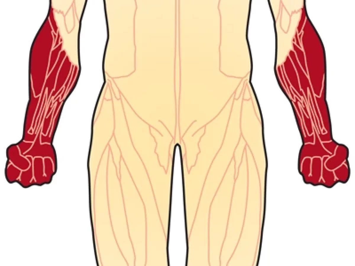 40-facts-about-distal-myopathy