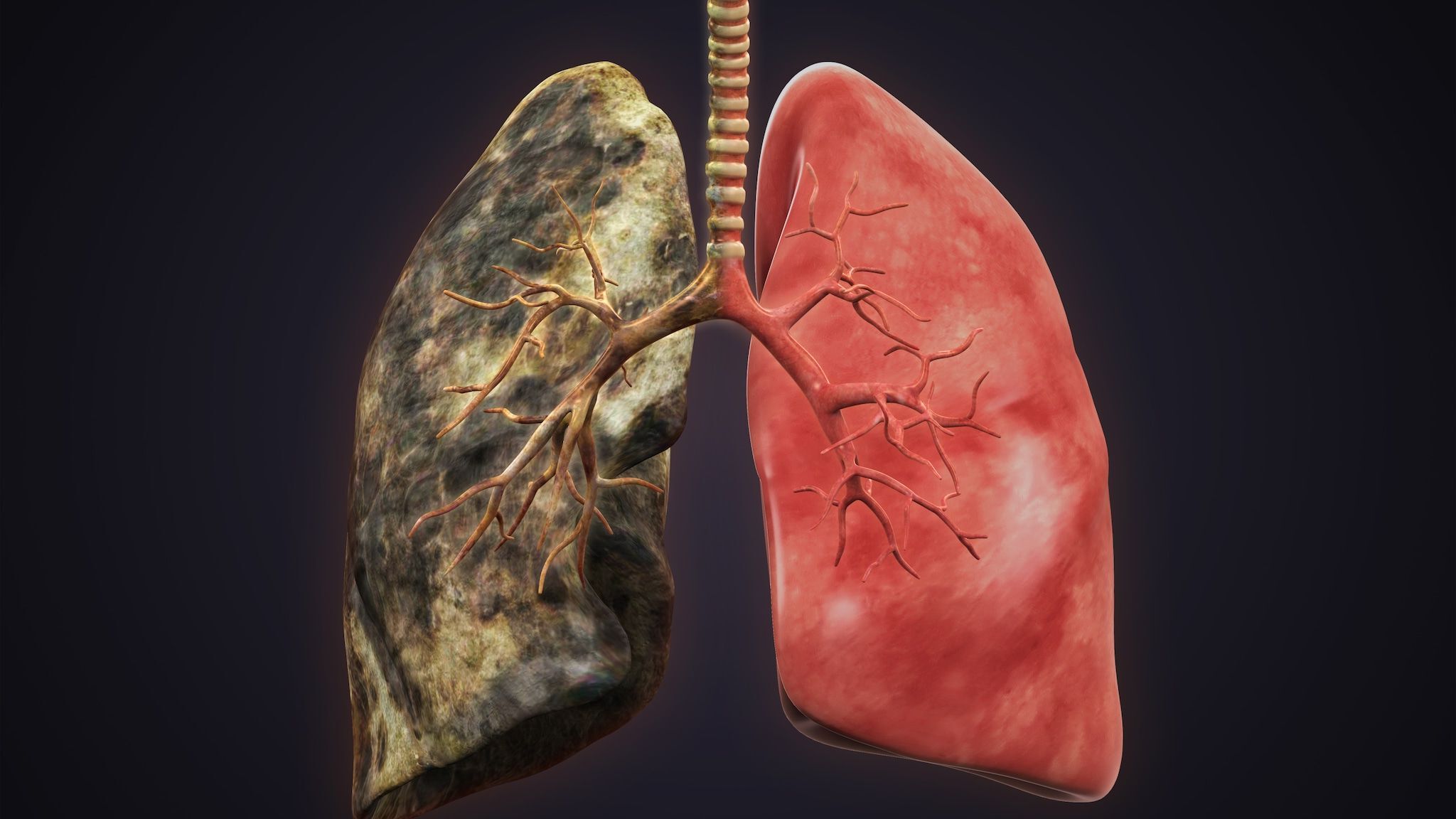 40-facts-about-graphite-pneumoconiosis