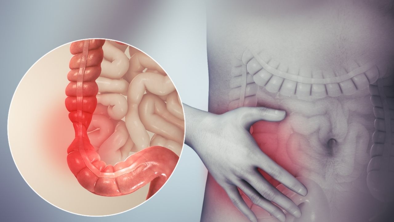 40-facts-about-irritable-bowel