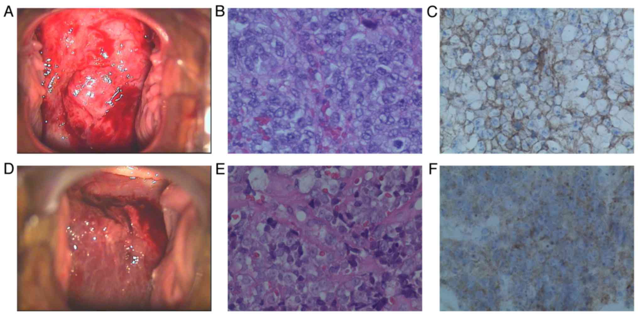 40-facts-about-primitive-neuroectodermal-tumor