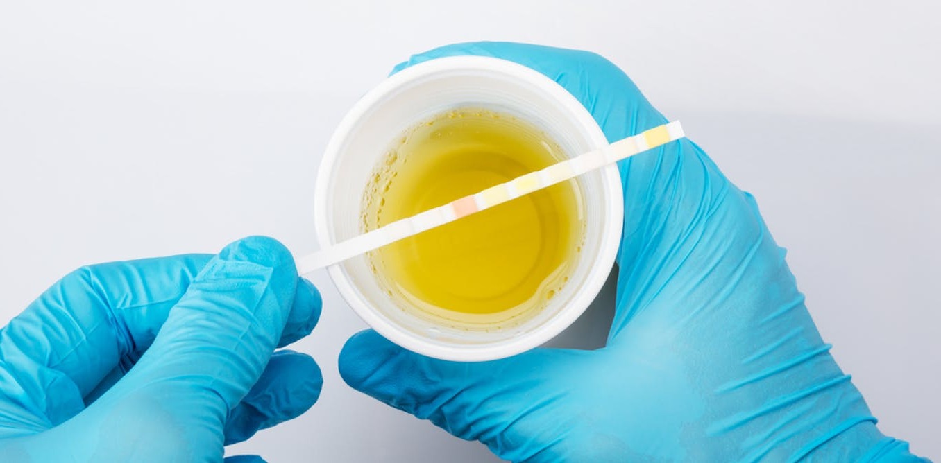 42-facts-about-urine-tests