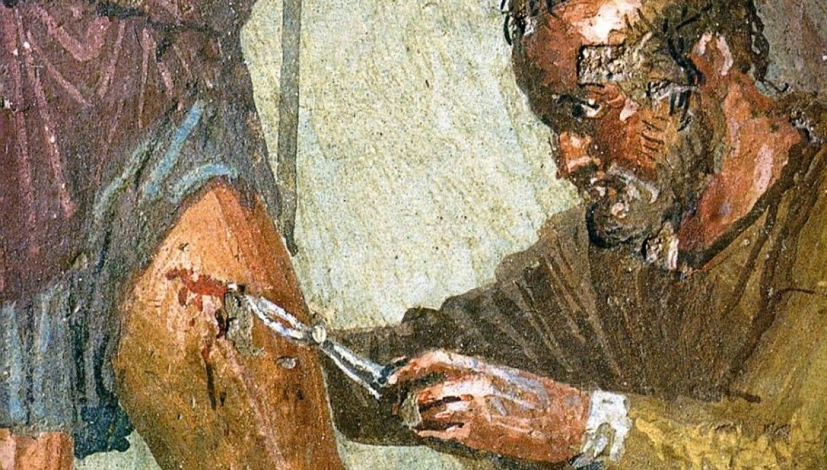 48-facts-about-ancient-roman-surgery-facts-net