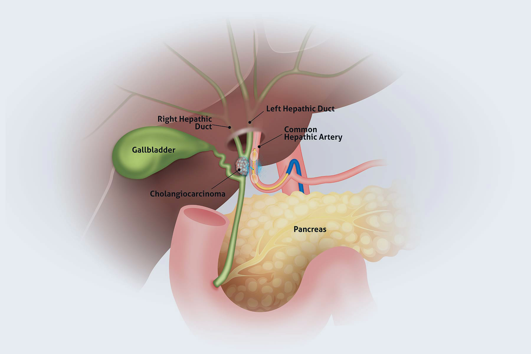 50-facts-about-bile-duct-cancer